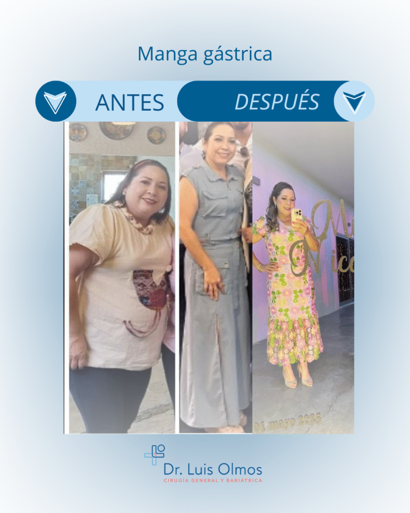 ANTES (9)