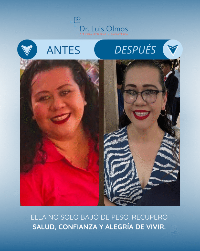 ANTES y después
