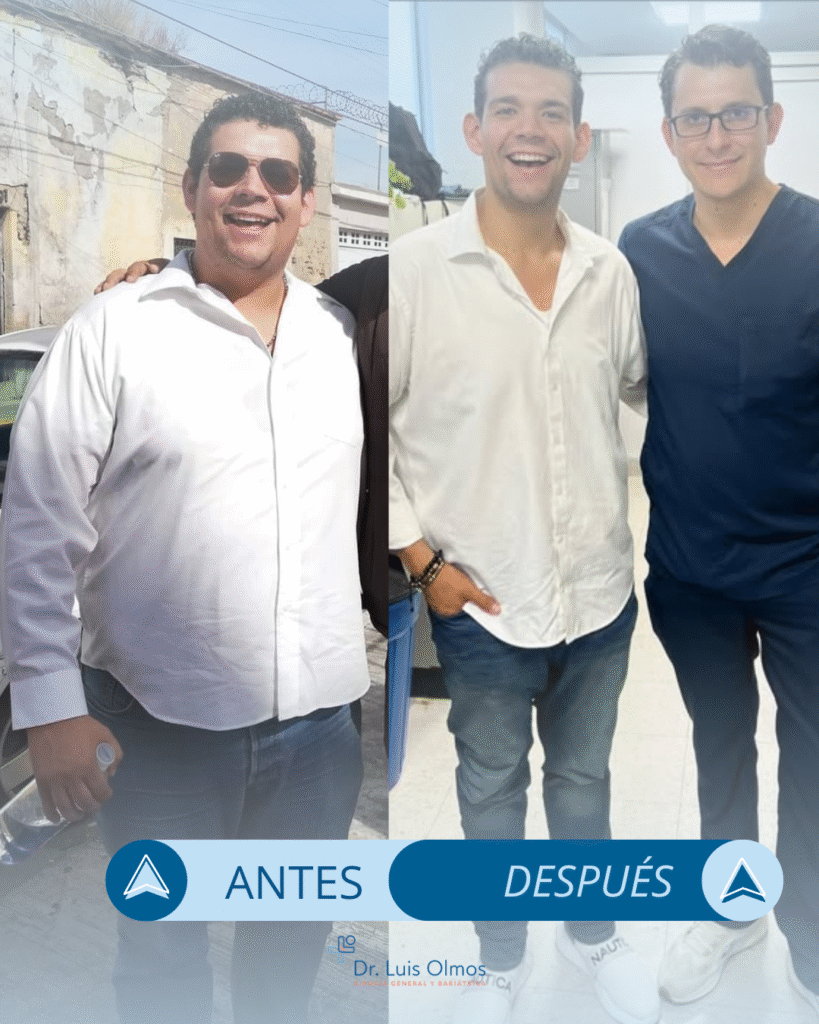 ANTES y después (1)