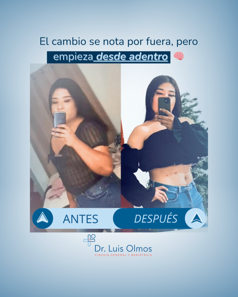 ANTES y después (2)