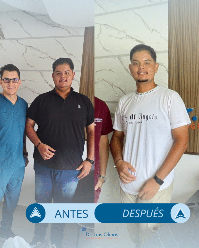ANTES y después (3)