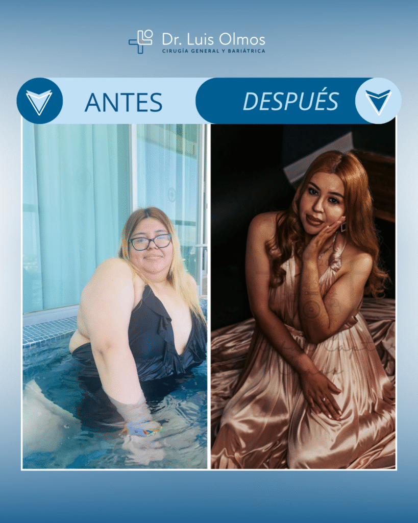 ANTES y después (4)