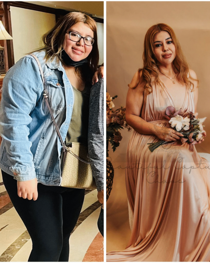 ANTES y después (5)